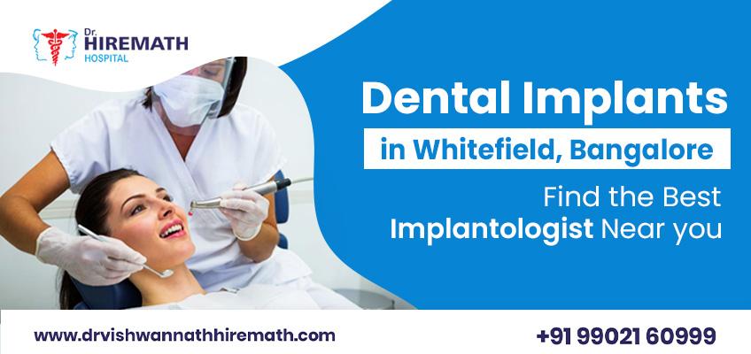 dental-implants-in-whitefield-bangalore