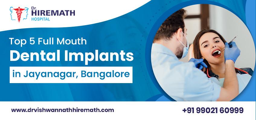 full-mouth-dental-implants-in-jayanagar-bangalore