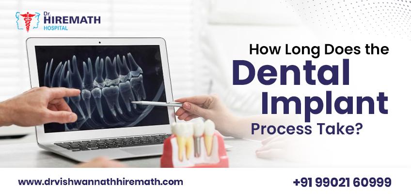 understanding-the-full-mouth-dental-implant-procedure